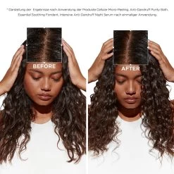 Kérastase Symbiose Bain Pureté Anti-Pelliculaire 250 Ml 11 Kérastase Symbiose Bain Pureté Anti-Pelliculaire 250 Ml -Bestes Haarpflege Geschäft 12107519 6