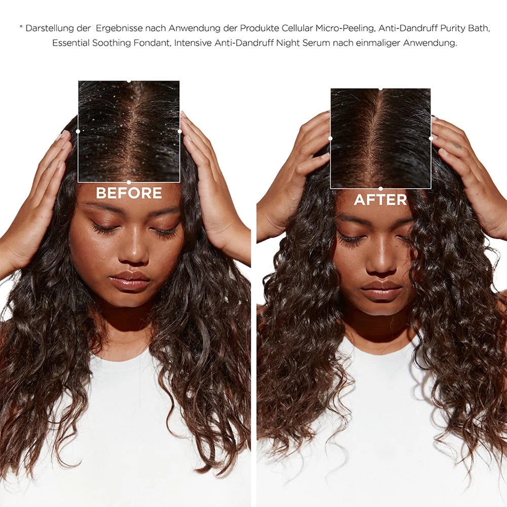 Kérastase Symbiose Masque Revitalisant Essentiel 200 Ml 3 Kérastase Symbiose Masque Revitalisant Essentiel 200 Ml – Bild 3